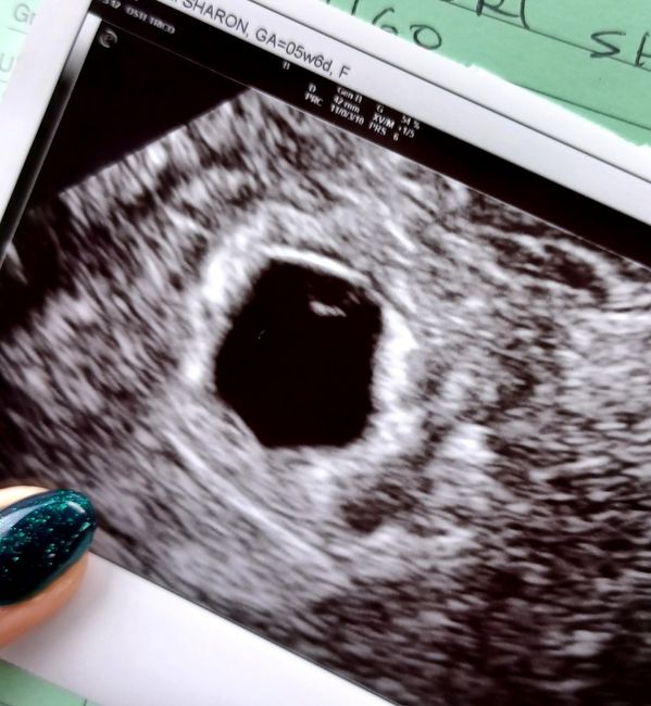 Future mamme Gennaio 2023 ❤️🍀 - 1