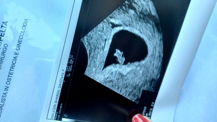 Future mamme Gennaio 2023 ❤️🍀 - 1