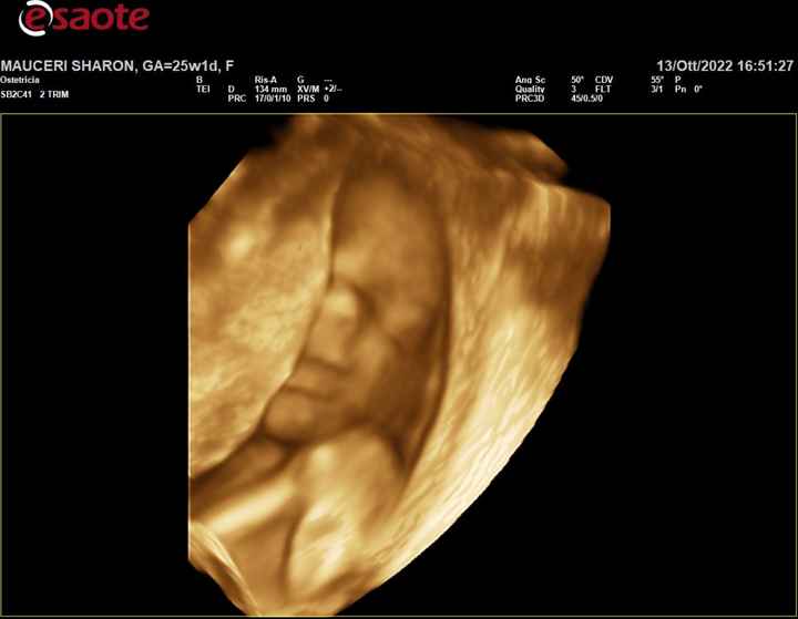 Future mamme Gennaio 2023 ❤️🍀 - 2