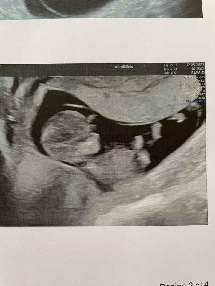 Nub theory. Maschio o femmina?💙🎀 - 1