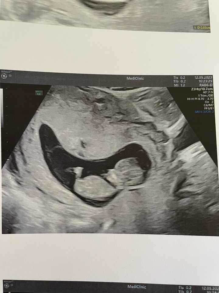 Nub theory. Maschio o femmina?💙🎀 - 2