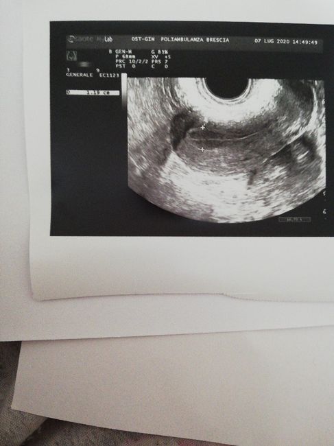 Mi aiutate a capire questa ecografia? - 2