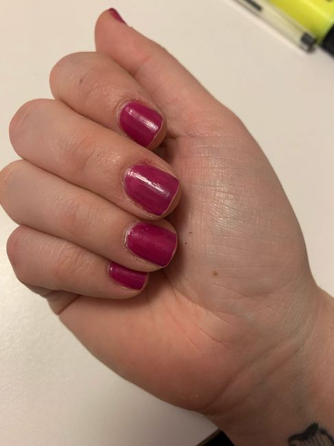 Help! fm si mangia le unghie 1