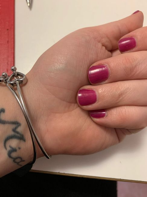 Help! fm si mangia le unghie 2