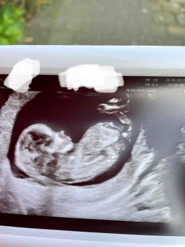 Esperte Nub theory mi aiutate? - 2