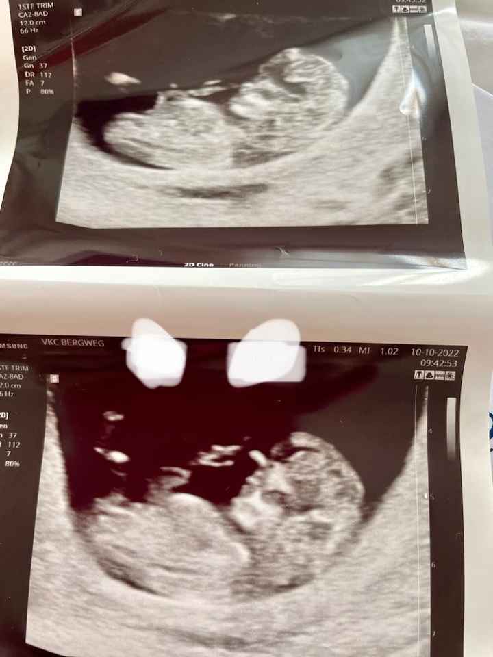 Esperte Nub theory mi aiutate? - 3