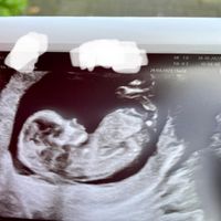 Esperte Nub theory mi aiutate? - 2