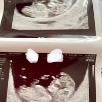 Esperte Nub theory mi aiutate? - 3