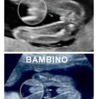 Maschio o femmina? - 1