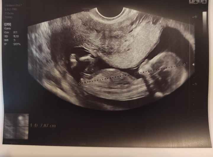 Future mamme Dicembre 2021 🎄🎁💙🎀 - 1