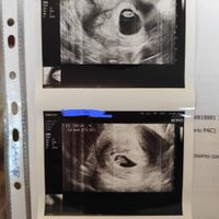 Future mamme Dicembre 2021 🎄🎁💙🎀 - 1