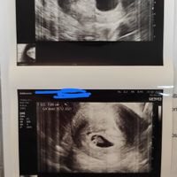 Nub theory. Maschio o femmina?💙🎀 - 1