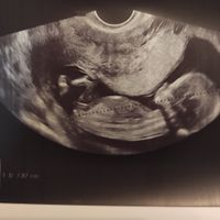 Future mamme Dicembre 2021 🎄🎁💙🎀 - 1