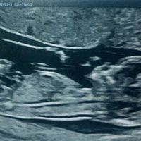 Future mamme maggio 2024 - 1