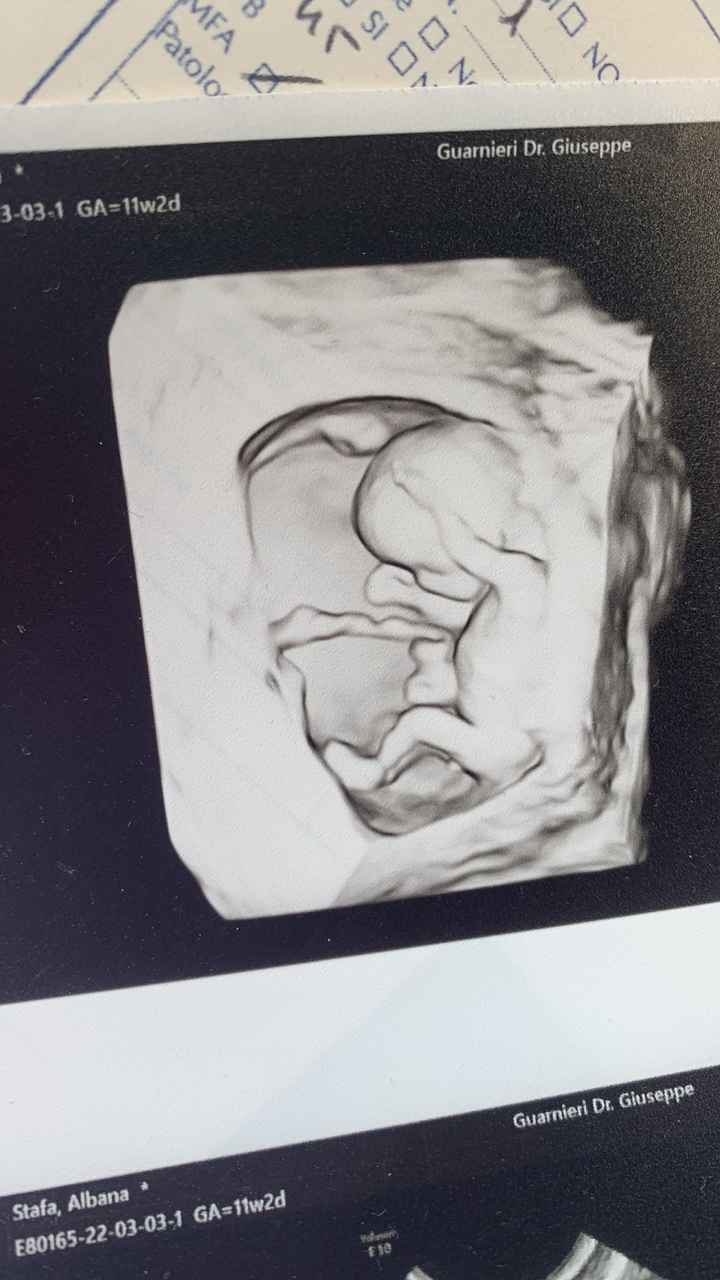 Future mamme ottobre 2022 - 1