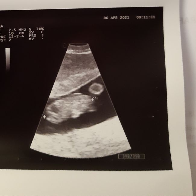 Future mamme novembre 2021 - 1