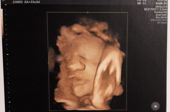Future mamme novembre 2021 - 1