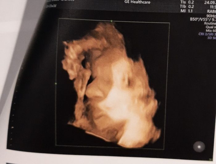 Future mamme novembre 2021 - 2
