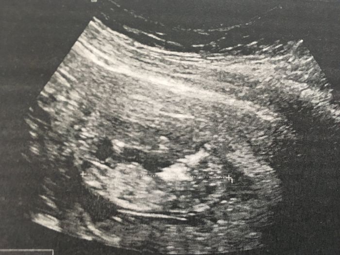 Future mamme Dicembre 2021 🎄🎁💙🎀 1