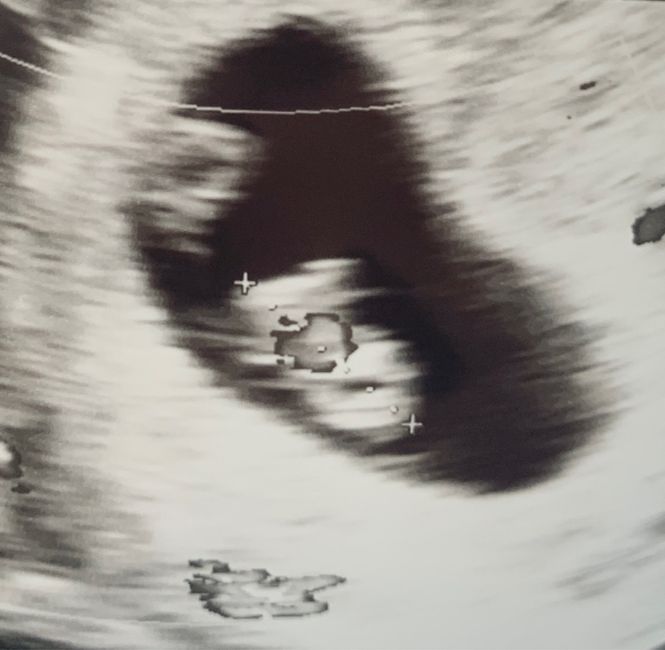 Future mamme Maggio 2023 - 1