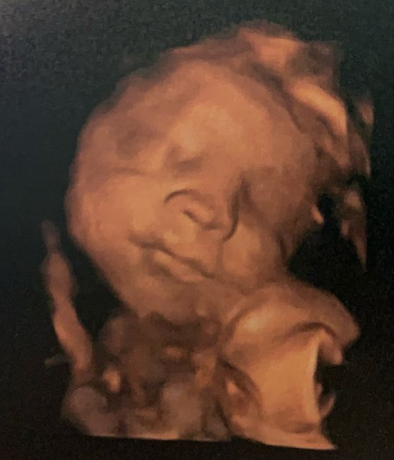 Future mamme Maggio 2023 - 1