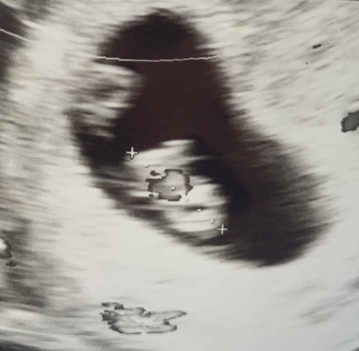 Future mamme Maggio 2023 - 1