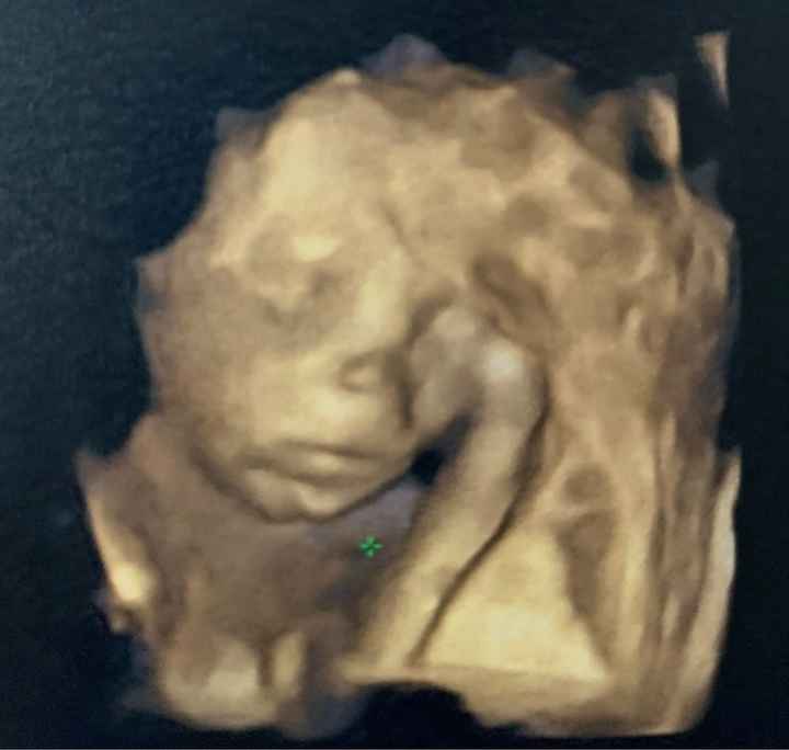 Future mamme Maggio 2023 - 1