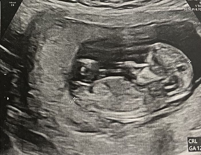 Nub theory, giochiamo un po’ 8