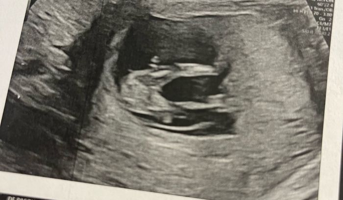 Nub theory, giochiamo un po’ 9