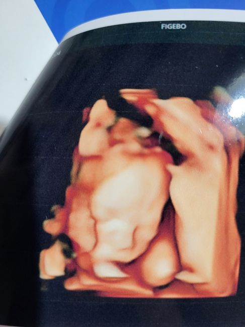 Future mamme febbraio/marzo/aprile 2026 🌸🌼🌿🌾 - 2