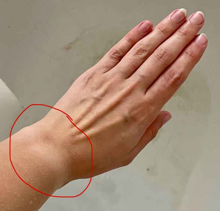Risolto il problema dell'abbronzatura sul polso? - 1
