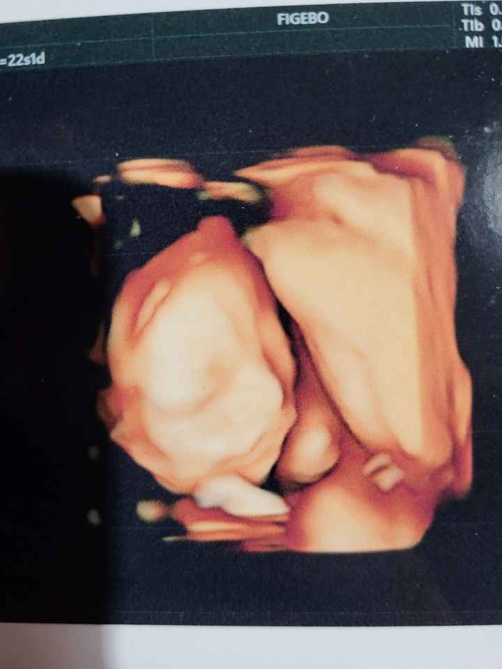 Future mamme febbraio/marzo/aprile 2026 🌸🌼🌿🌾 - 1