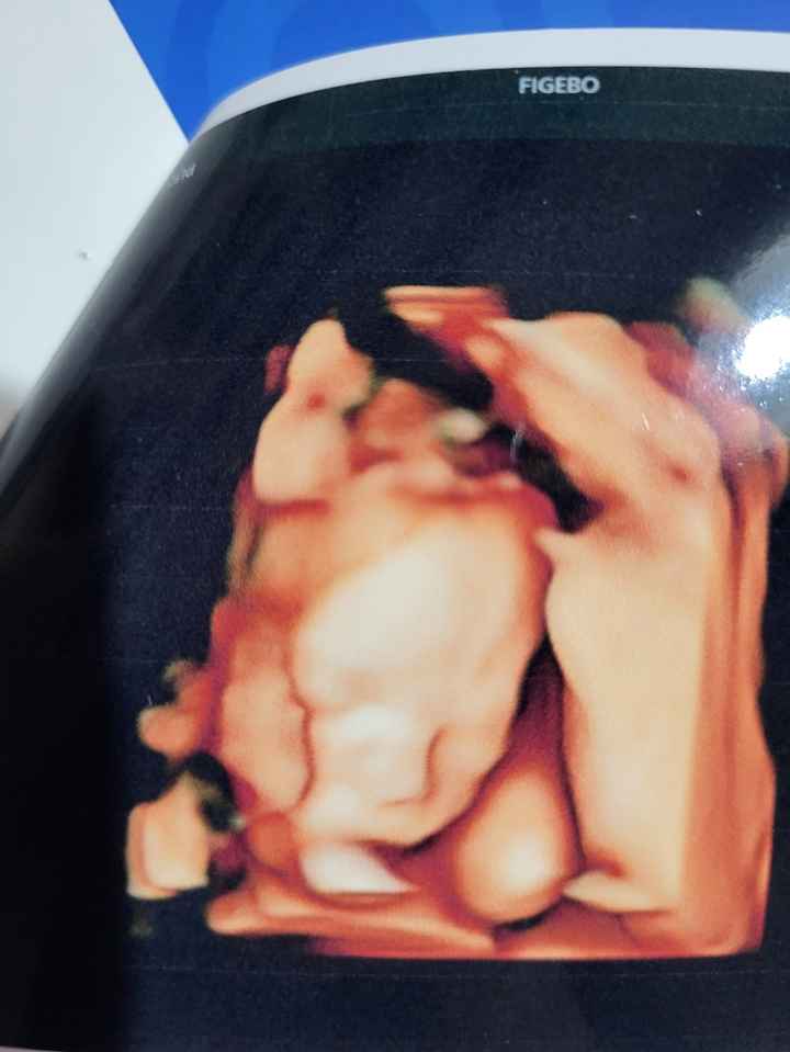 Future mamme febbraio/marzo/aprile 2026 🌸🌼🌿🌾 - 2