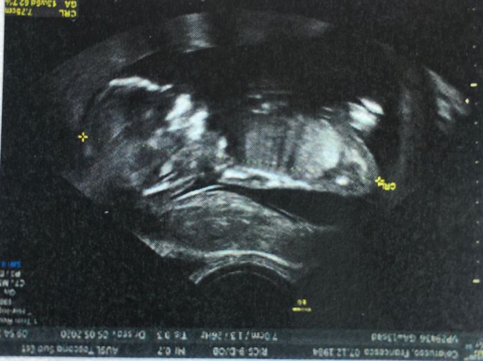 Future mamme novembre 2020 🌞🍁🌷♾ - 1