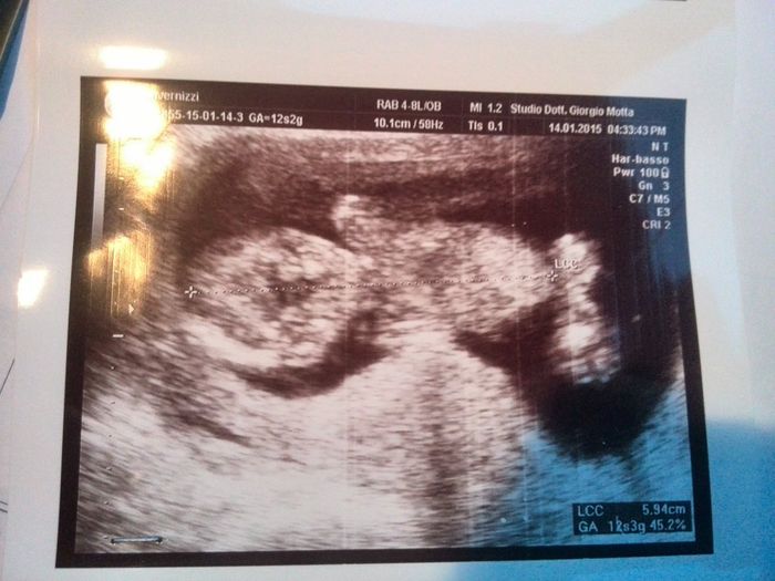 Pensieri e paure  - 1