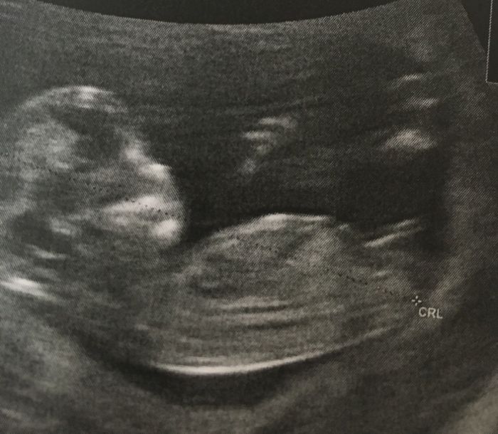 Esperte Nub Theory - 1