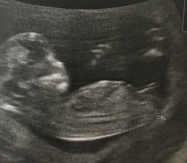 Esperte Nub Theory - 1