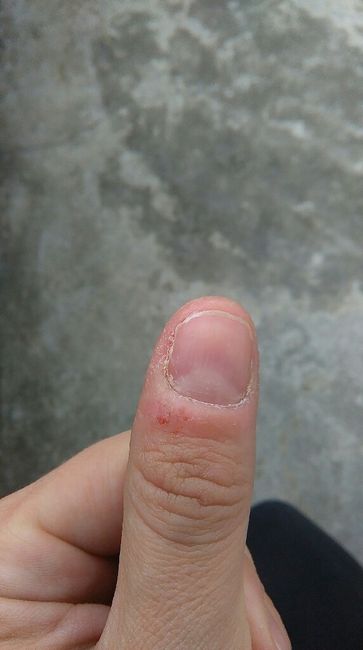 Brutto vizio, come smetto? - 1