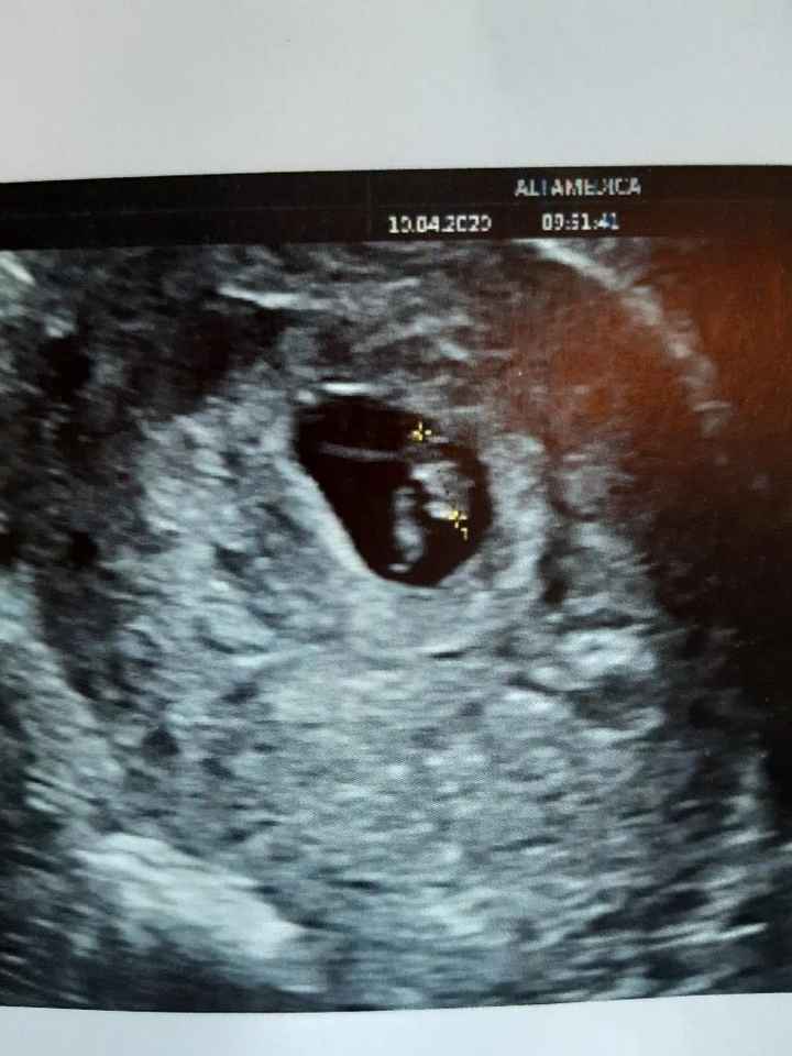 Ramzi ne ha beccate 2 su 2❤️❤️ 1