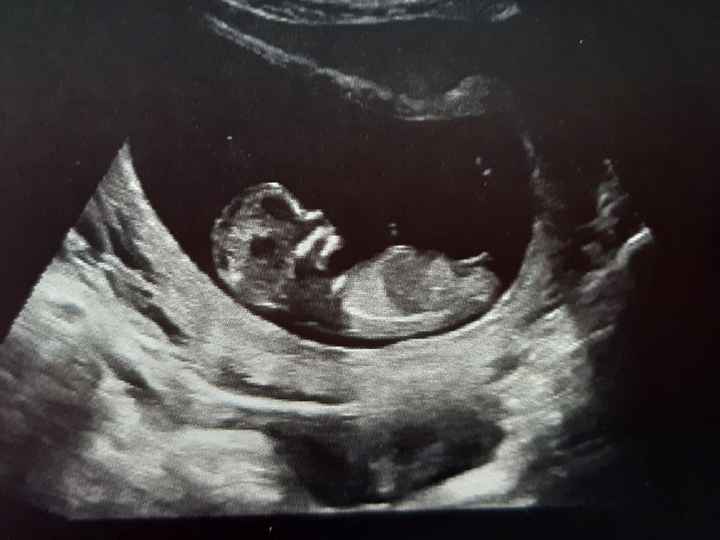 Ramzi ne ha beccate 2 su 2❤️❤️ 2