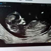 Esperte Nub Theory - 1