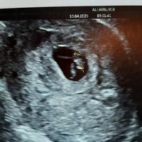 Ramzi ne ha beccate 2 su 2❤️❤️ - 1