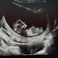 Ramzi ne ha beccate 2 su 2❤️❤️ - 2