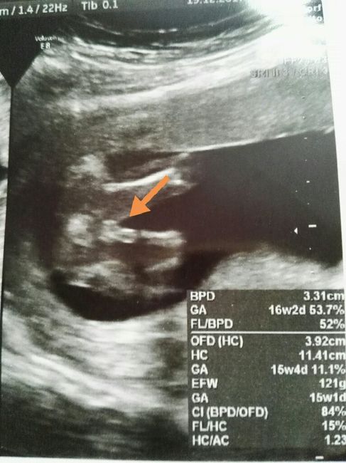 Future mamme maggio-giugno/2018 1