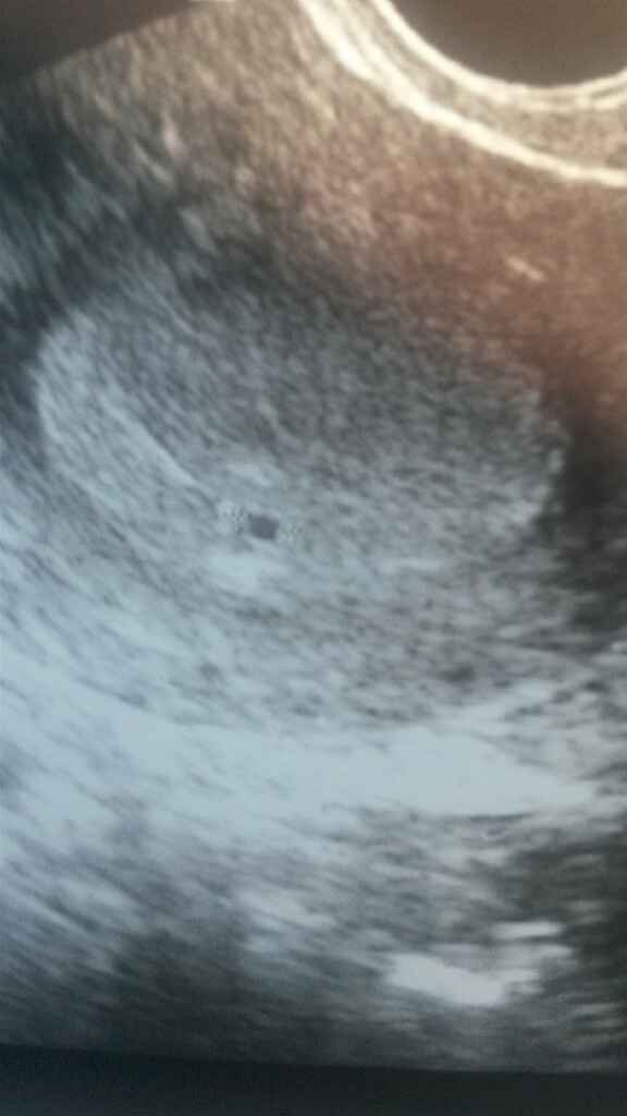 4 settimane + 2 giorni - 1