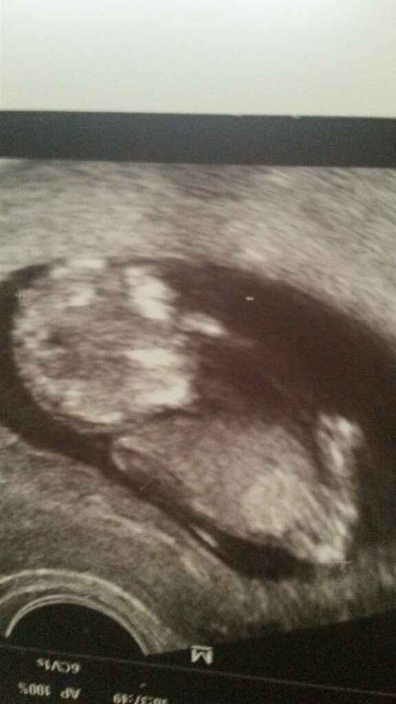 Il nostro grillo - 1