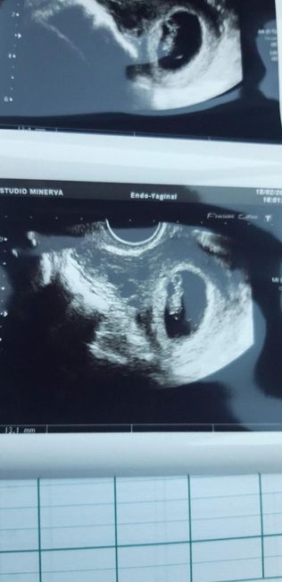 Metodo Ramzi! Chi ci sa azzeccare? - 1