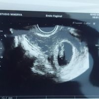 Metodo Ramzi! Chi ci sa azzeccare? - 1