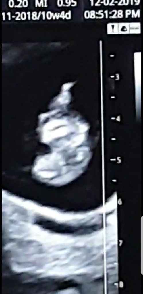 Future mamma settembre 2019 - 1