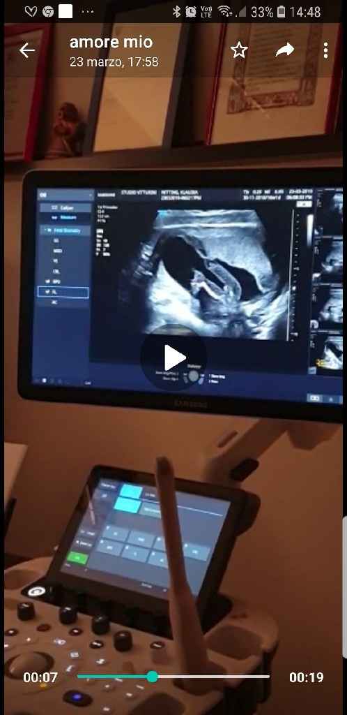 Maschietto o femminuccia? - 1